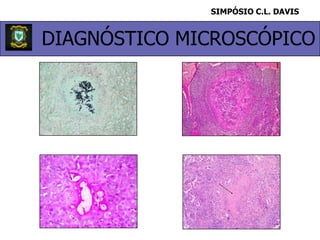 SIMPÓSIO C.L. DAVISDIAGNÓSTICO MICROSCÓPICO