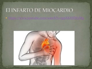  https://www.youtube.com/watch?v=tppXKHSWyMg
 