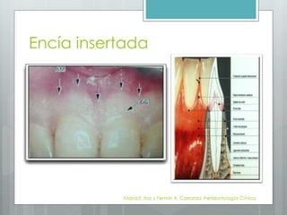 Encía | PPTX