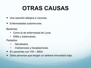 OTRAS CAUSAS
 Una reacción alérgica a vacunas.

 Enfermedades autoinmunes.

Bacterias:
  • Como la de enfermedad de Lyme.
  • Sífilis y tuberculosis.
Parásitos:
   • Nemátodos.
   • Cisticercosis y toxoplasmosis.
 En pacientes con VIH – SIDA.
 Otras personas que tengan un sistema inmunitario bajo.
 