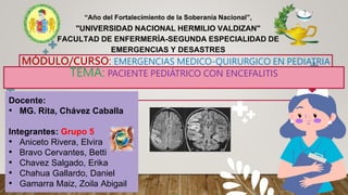 "UNIVERSIDAD NACIONAL HERMILIO VALDIZAN"
FACULTAD DE ENFERMERÍA-SEGUNDA ESPECIALIDAD DE
EMERGENCIAS Y DESASTRES
Docente:
• MG. Rita, Chávez Caballa
Integrantes: Grupo 5
• Aniceto Rivera, Elvira
• Bravo Cervantes, Betti
• Chavez Salgado, Erika
• Chahua Gallardo, Daniel
• Gamarra Maiz, Zoila Abigail
“Año del Fortalecimiento de la Soberanía Nacional”,
MÓDULO/CURSO: EMERGENCIAS MEDICO-QUIRURGICO EN PEDIATRIA
TEMA: PACIENTE PEDIÁTRICO CON ENCEFALITIS
 