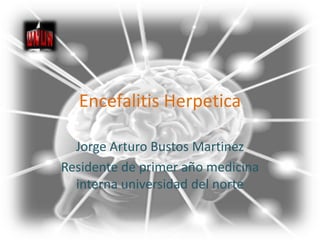 Encefalitis Herpetica Jorge Arturo Bustos Martinez Residente de primer año medicina interna universidad del norte 