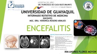 ENCEFALITIS
IRM ANDRES FLORES MOYON
UNIVERSIDAD DE GUAYAQUIL
INTERNADO ROTATIVO DE MEDICINA
DOCENTE:
MSC. DRA. VERONICA ROSERO ARMIJOS
 