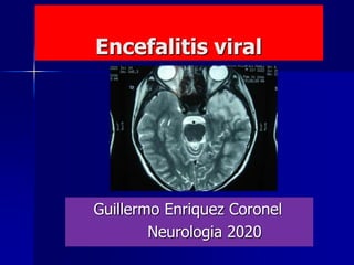 Encefalitis viral
Guillermo Enriquez Coronel
Neurologia 2020
 