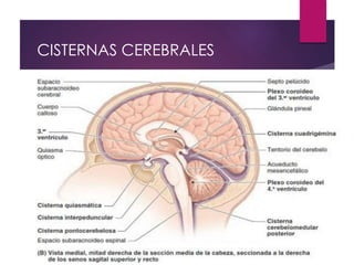 CISTERNAS CEREBRALES
 