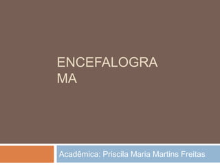 ENCEFALOGRA
MA
Acadêmica: Priscila Maria Martins Freitas
 