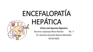 ENCEFALOPATÍA
HEPÁTICA
Clínica del Aparato Digestivo
Alumno: Espinoza Mora Ramón NL: 7
Dr. Antonio Gerardo Manzo Montaño
30-03-2022
 