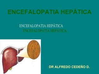 ENCEFALOPATIA HEPÁTICA
DR ALFREDO CEDEÑO D.
 