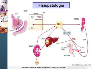Córdoba J, Mínguez B. Hepatic encephalopathy. Semin Liver Dis 2008
 