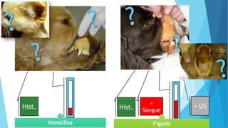 Hist.
+
Sangue
+ USHist.
Hemólise Fígado
 