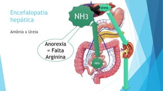 Encefalopatia
hepática
Amônia x Ureia
NH3
NH3
Ureia
Anorexia
= Falta
Arginina
NH3NH3NH3
 