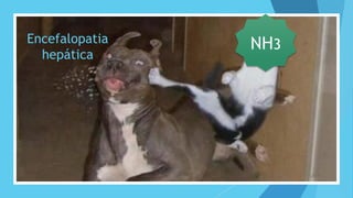 NH3Encefalopatia
hepática
 
