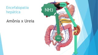 Encefalopatia
hepática
Amônia x Ureia
NH3
NH3
Ureia
NH3NH3NH3
 