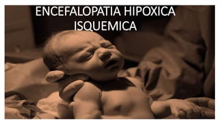 ENCEFALOPATIA HIPOXICA
ISQUEMICA
 