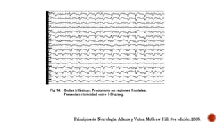 Principios de Neurologia. Adams y Victor. McGraw Hill. 8va edición. 2005.
 