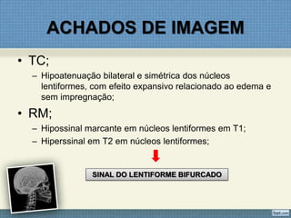ACHADOS DE IMAGEM
• TC;
– Hipoatenuação bilateral e simétrica dos núcleos
lentiformes, com efeito expansivo relacionado ao edema e
sem impregnação;
• RM;
– Hipossinal marcante em núcleos lentiformes em T1;
– Hiperssinal em T2 em núcleos lentiformes;
SINAL DO LENTIFORME BIFURCADO
 