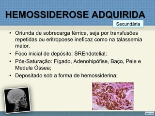 HEMOSSIDEROSE ADQUIRIDA
• Oriunda de sobrecarga férrica, seja por transfusões
repetidas ou eritropoese ineficaz como na talassemia
maior.
• Foco inicial de depósito: SREndotelial;
• Pós-Saturação: Fígado, Adenohipófise, Baço, Pele e
Medula Óssea;
• Depositado sob a forma de hemossiderina;
Secundária
 