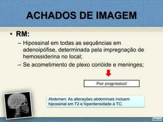 ACHADOS DE IMAGEM
• RM:
– Hipossinal em todas as sequências em
adenoipófise, determinada pela impregnação de
hemossiderina no local;
– Se acometimento de plexo corióide e meninges;
Pior prognóstico!
Abdomen: As alterações abdominais incluem
hipossinal em T2 e hiperdensidade à TC;
 