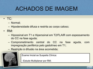 ACHADOS DE IMAGEM
• TC:
– Normal;
– Hipodensidade difusa e restrita ao corpo caloso;
• RM:
– Hipossinal em T1 e Hiperssinal em T2/FLAIR com espessamento
do CC na fase aguda;
– Comprometimento central do CC na fase aguda, com
impregnação periférica pelo gadolíneo em T1;
– Restrição à difusão na área acometida;
Exame Inicial se Suspeita Clínica:
- Estudo Multiplanar por RM;
 