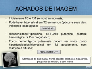 ACHADOS DE IMAGEM
• Inicialmente TC e RM se mostram normais;
• Pode haver hiperssinal em T2 em nervos ópticos e suas vias,
indicando lesão aguda;
• Hipodensidade/Hiperssinal T2-FLAIR putaminal bilateral
hemorrágica  Pior prognóstico;
• Focos hemorrágicos putaminais podem ser vistos como
hiperdensidades/hiperssinal em T2 agudamente, com
restrição à difusão;
24 HORAS
CRONICAMENTE
Alterações de sinal na SB fronto-occiptal, cerebelo e hipocampo,
poupando as fibras U e sem realce
 