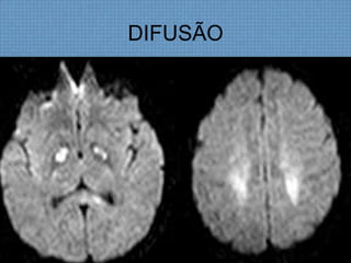 DIFUSÃO
 