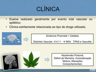 CLÍNICA
• Exame realizado geralmente por evento ictal vascular ou
epilético;
• Clínica estritamente relacionada ao tipo de droga utilizada;
Síndrome Piramidal + Cefaléia
Distúrbio Vascular H 4:1 I  MAV, PAS e Vasculite
Hipotensão Postural,
Déficit de Memória, Incoordenação
Motora, Alterações
Comportamentais;
 
