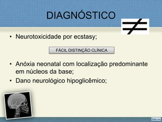 DIAGNÓSTICO
• Neurotoxicidade por ecstasy;
• Anóxia neonatal com localização predominante
em núcleos da base;
• Dano neurológico hipoglicêmico;
FÁCIL DISTINÇÃO CLÍNICA
 