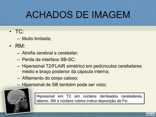 ACHADOS DE IMAGEM
• TC:
– Muito limitada;
• RM:
– Atrofia cerebral e cerebelar;
– Perda da interface SB-SC;
– Hiperssinal T2/FLAIR simétrico em pedúnculos cerebelares
médio e braço posterior da cápsula interna;
– Afilamento do corpo caloso;
– Hiperssinal de SB também pode ser visto;
Hipossinal em T2 em núcleos denteados cerebelares,
tálamo, SN e núcleos rubros indica deposição de Fe;
 