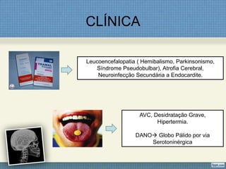 CLÍNICA
Leucoencefalopatia ( Hemibalismo, Parkinsonismo,
Síndrome Pseudobulbar), Atrofia Cerebral,
Neuroinfecção Secundária a Endocardite.
AVC, Desidratação Grave,
Hipertermia.
DANO Globo Pálido por via
Serotoninérgica
 