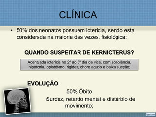 CLÍNICA
• 50% dos neonatos possuem icterícia, sendo esta
considerada na maioria das vezes, fisiológica;
QUANDO SUSPEITAR DE KERNICTERUS?
EVOLUÇÃO:
50% Óbito
Surdez, retardo mental e distúrbio de
movimento;
Acentuada icterícia no 2º ao 5º dia de vida, com sonolência,
hipotonia, opistótono, rigidez, choro agudo e baixa sucção;
 