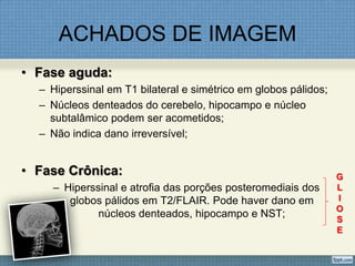 ACHADOS DE IMAGEM
• Fase aguda:
– Hiperssinal em T1 bilateral e simétrico em globos pálidos;
– Núcleos denteados do cerebelo, hipocampo e núcleo
subtalâmico podem ser acometidos;
– Não indica dano irreversível;
• Fase Crônica:
– Hiperssinal e atrofia das porções posteromediais dos
globos pálidos em T2/FLAIR. Pode haver dano em
núcleos denteados, hipocampo e NST;
G
L
I
O
S
E
 