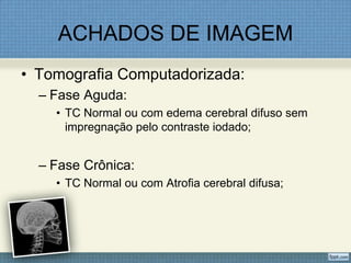 ACHADOS DE IMAGEM
• Tomografia Computadorizada:
– Fase Aguda:
• TC Normal ou com edema cerebral difuso sem
impregnação pelo contraste iodado;
– Fase Crônica:
• TC Normal ou com Atrofia cerebral difusa;
 