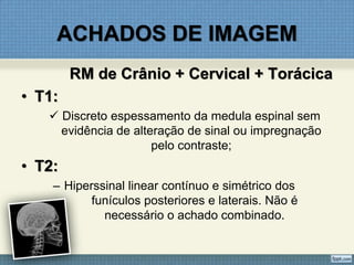 ACHADOS DE IMAGEM
RM de Crânio + Cervical + Torácica
• T1:
 Discreto espessamento da medula espinal sem
evidência de alteração de sinal ou impregnação
pelo contraste;
• T2:
– Hiperssinal linear contínuo e simétrico dos
funículos posteriores e laterais. Não é
necessário o achado combinado.
 
