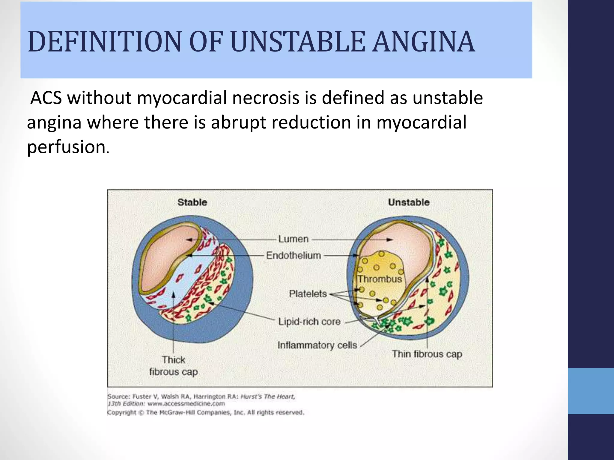 Acute coronary syndrome | PPTX