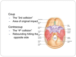 head injury | PPTX