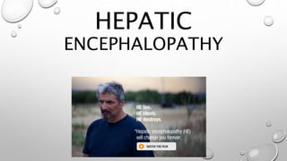 HEPATIC
ENCEPHALOPATHY
 