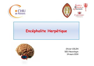 Encéphalite Herpétique
Olivier COLIN
DES Neurologie
14 mars 2014
 