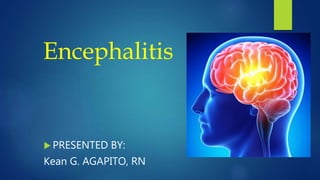 Encephalitis
 PRESENTED BY:
Kean G. AGAPITO, RN
 