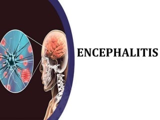 ENCEPHALITIS
 