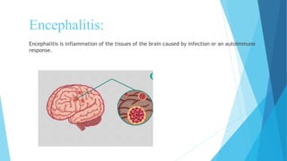 ENCEPHALITIS. present by Dr Nasir Uddin. | PDF
