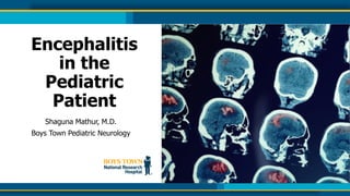 Encephalitis
in the
Pediatric
Patient
Shaguna Mathur, M.D.
Boys Town Pediatric Neurology
 