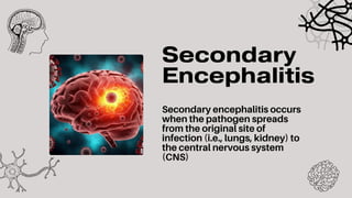 Comprehensive Overview of Encephalitis: Causes, Symptoms, and Nursing ...