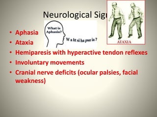 Neurological Signs
• Aphasia
• Ataxia
• Hemiparesis with hyperactive tendon reflexes
• Involuntary movements
• Cranial nerve deficits (ocular palsies, facial
weakness)
 