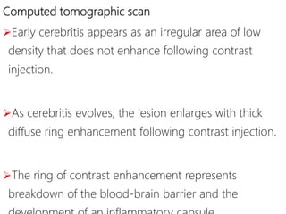 Computed tomographic scan
Early cerebritis appears as an irregular area of low
density that does not enhance following contrast
injection.
As cerebritis evolves, the lesion enlarges with thick
diffuse ring enhancement following contrast injection.
The ring of contrast enhancement represents
breakdown of the blood-brain barrier and the
 