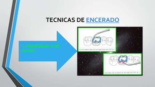 TECNICAS DE ENCERADO
1.TRADICIONAL O DE
GOTEO
 