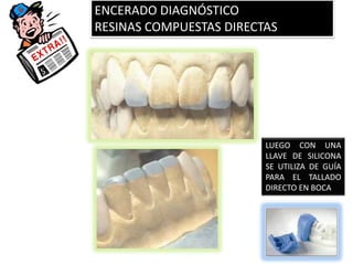 ENCERADO DIAGNÓSTICO
RESINAS COMPUESTAS DIRECTAS




                         LUEGO CON UNA
                         LLAVE DE SILICONA
                         SE UTILIZA DE GUÍA
                         PARA EL TALLADO
                         DIRECTO EN BOCA
 