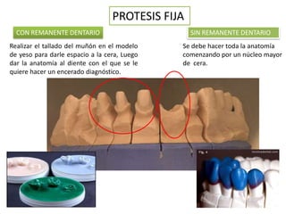 PROTESIS FIJA
  CON REMANENTE DENTARIO                          SIN REMANENTE DENTARIO
Realizar el tallado del muñón en el modelo    Se debe hacer toda la anatomía
de yeso para darle espacio a la cera, Luego   comenzando por un núcleo mayor
dar la anatomía al diente con el que se le    de cera.
quiere hacer un encerado diagnóstico.
 
