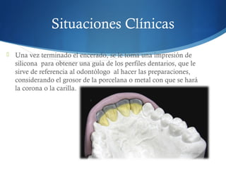 Situaciones Clínicas
 Una vez terminado el encerado, se le toma una impresión de
  silicona  para obtener una guía de los perfiles dentarios, que le
  sirve de referencia al odontólogo  al hacer las preparaciones,
  considerando el grosor de la porcelana o metal con que se hará
  la corona o la carilla.
 