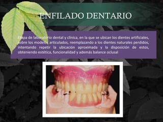 ENFILADO DENTARIO
Etapa de laboratorio dental y clínica, en la que se ubican los dientes artificiales,
sobre los modelos articulados, reemplazando a los dientes naturales perdidos,
intentando repetir la ubicación aproximada y la disposición de estos,
obteniendo estética, funcionalidad y además balance oclusal
 