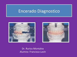Encerado DiagnosticoEncerado Diagnostico
Dr. Rurico Montalva
Alumno: Francisca Lavín
 